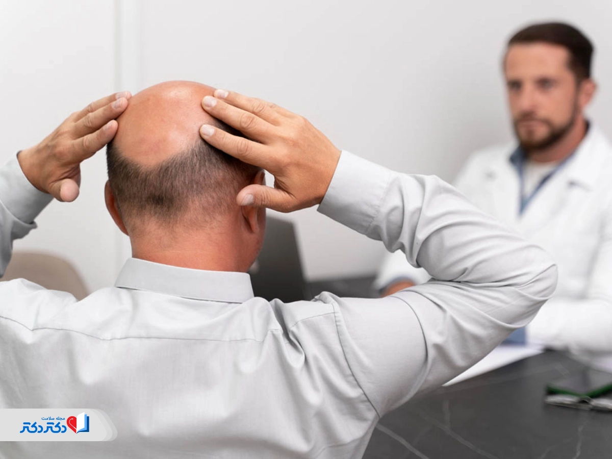 ارتباط تستوسترون و ریزش مو