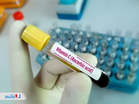 آزمایش ویتامین C چیست؟ تفسیر و عوارض کمبود VIT C