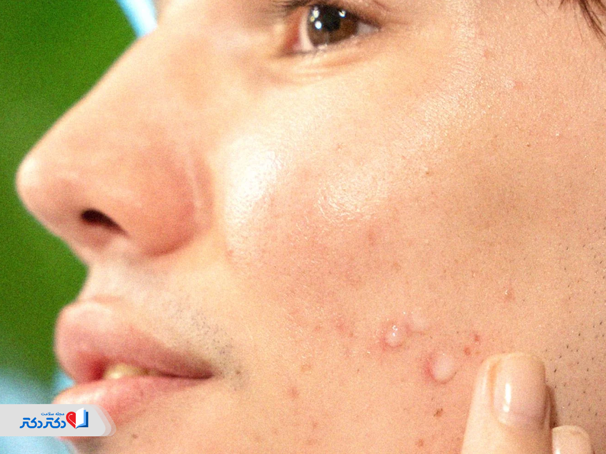 تشخیص کوکتل فیوژن اصل