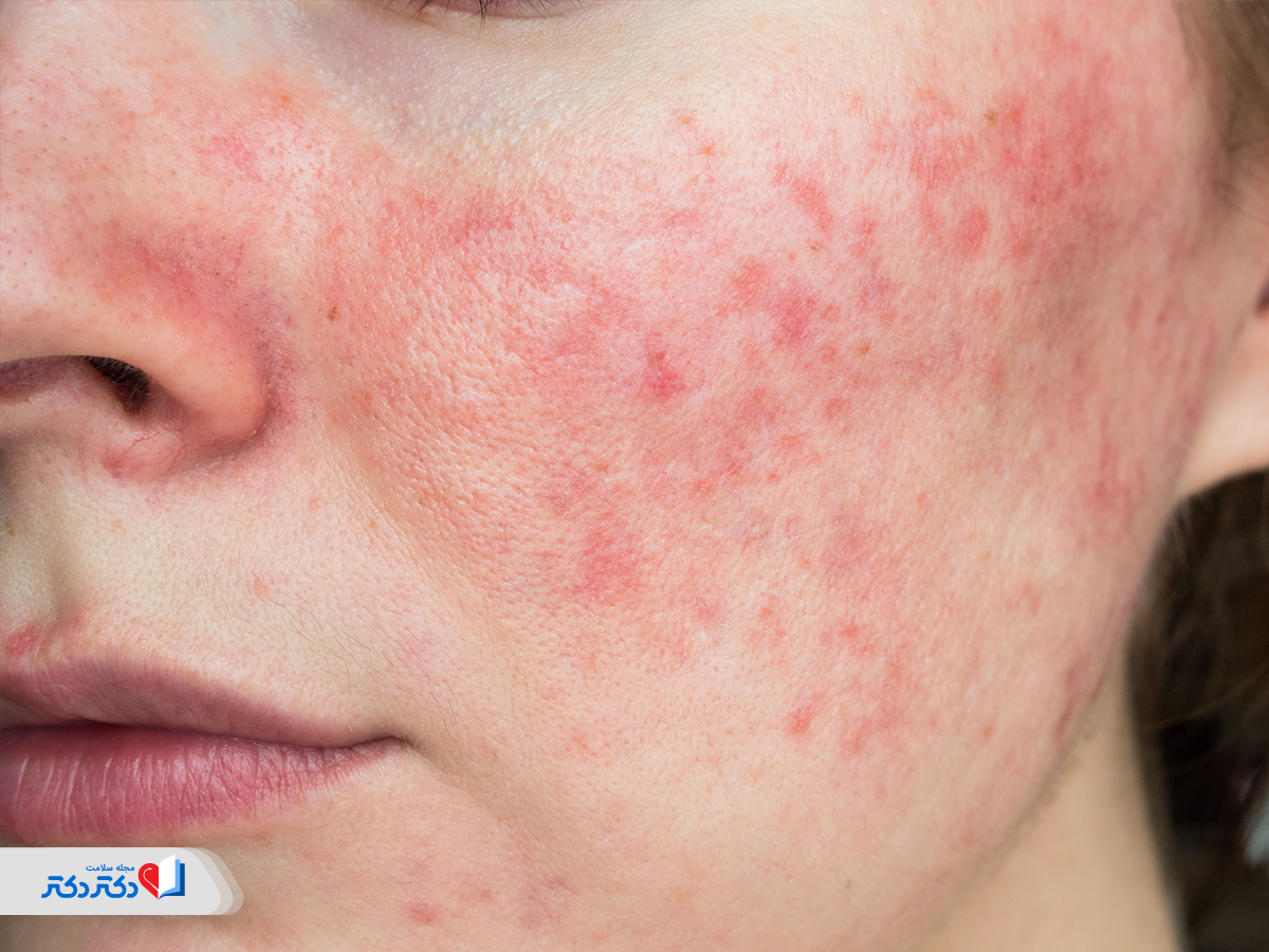 کوکتل فیوژن چگونه عمل میکند؟