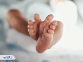 آشنایی با آزمایش گالاکتوز و نحوه تفسیر آن