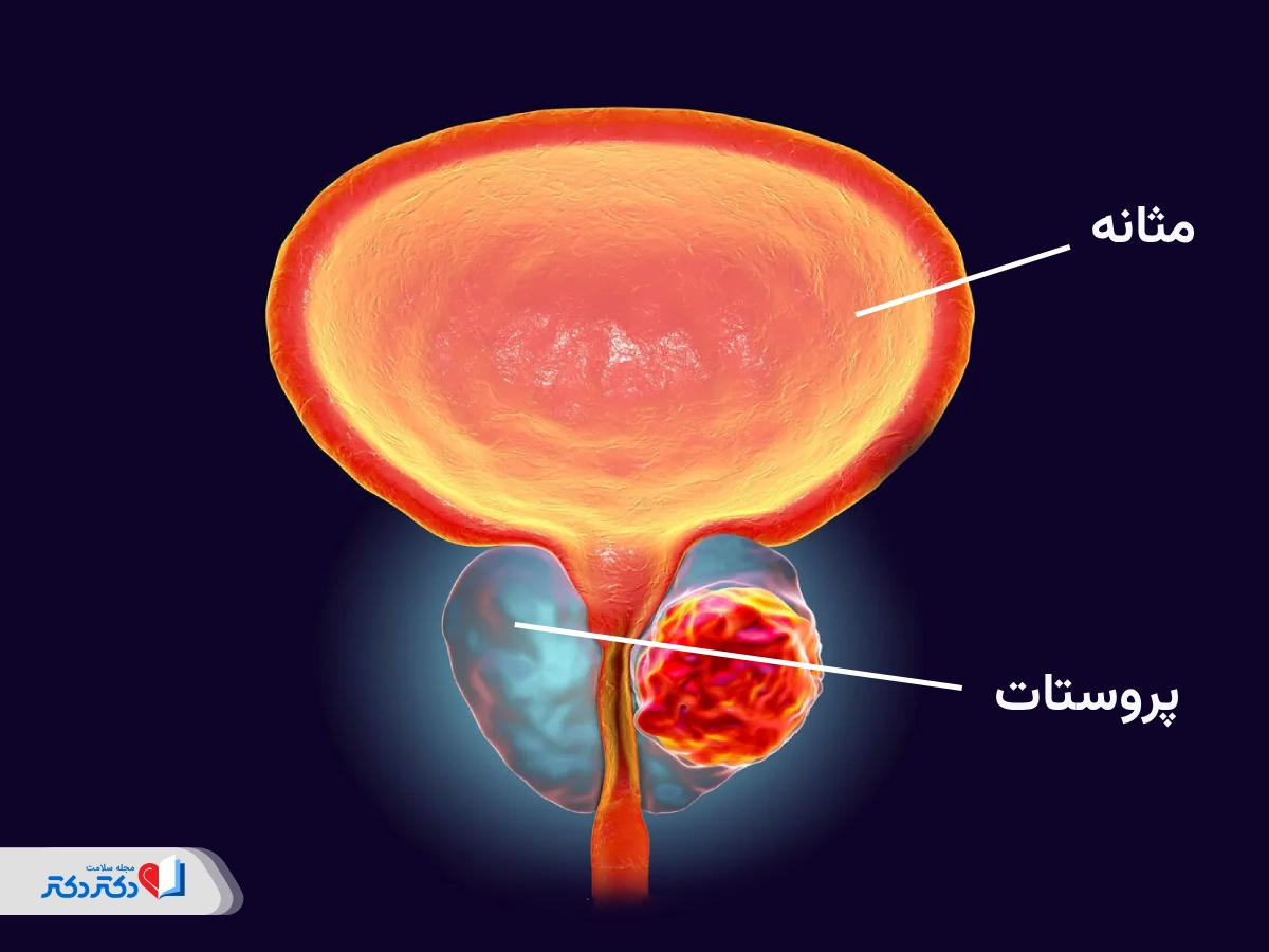 پروستات چیست و کجا قرار گرفته است؟
