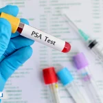 آزمایش پروستات (PSA) چیست؟ تفسیر نتایج و زمان انجام این آزمایش