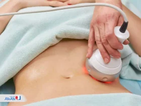 لاغری موضعی با دستگاه؛ راهنمای کامل کاهش وزن با ابزارهای چربی‌سوز