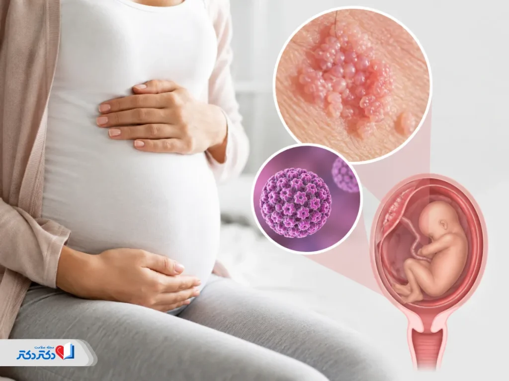 عکس زگیل تناسلی در بارداری