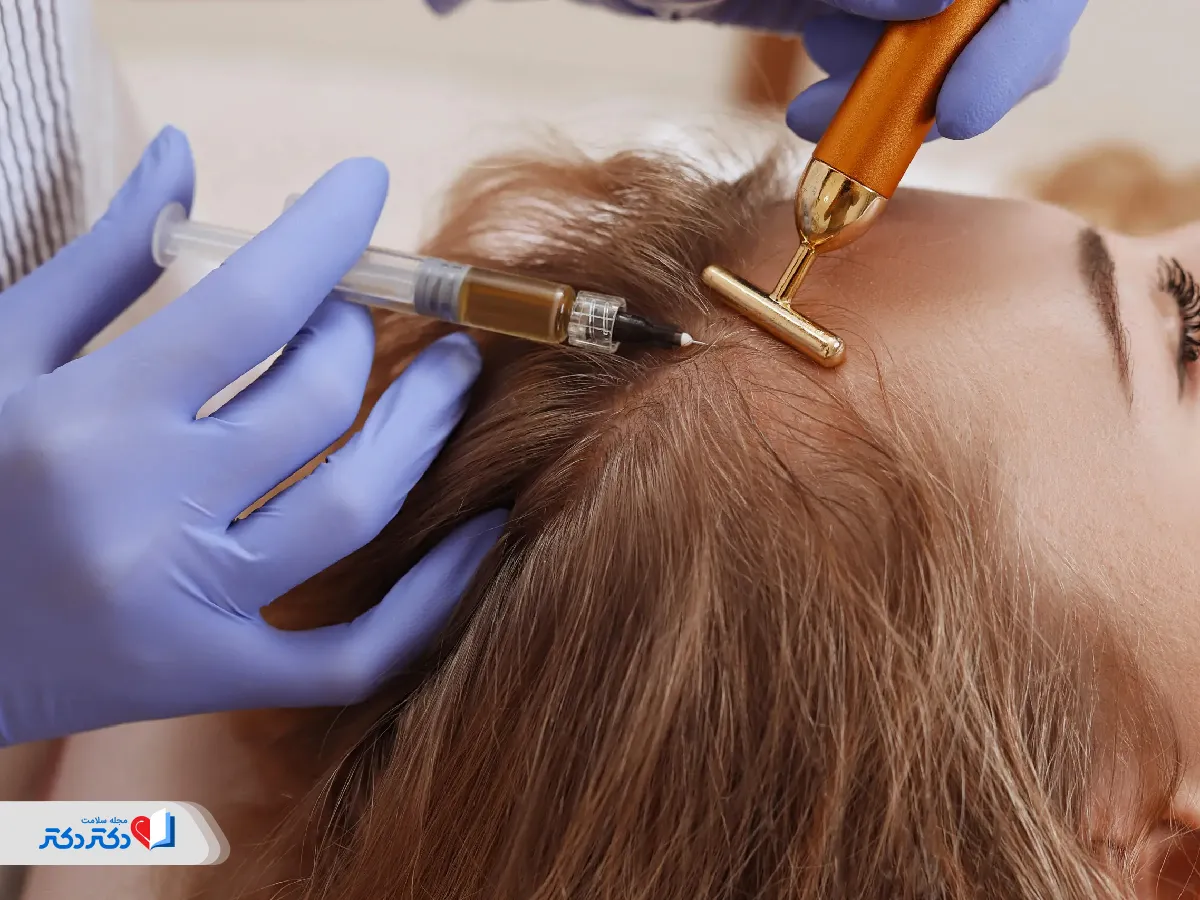 مزوتراپی مو چیست؟ هزینه، تعداد جلسات و نتایج واقعی