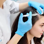 پی‌آرپی مو؛ میزان اثربخشی، عوارض و مقایسه با مزوتراپی