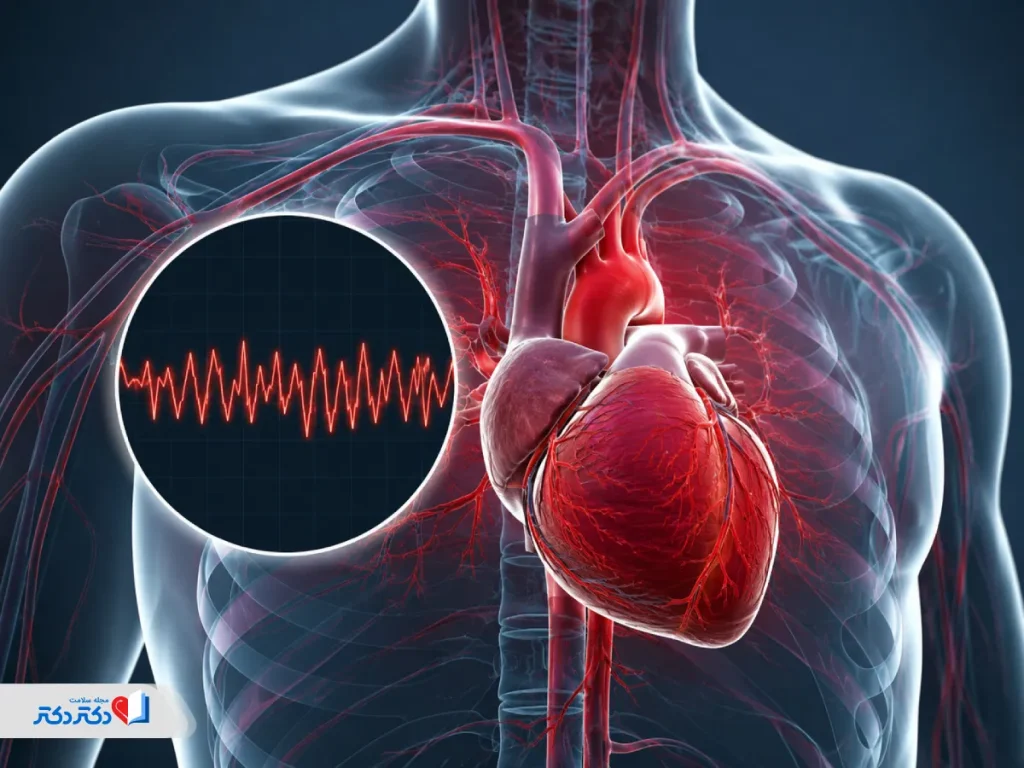 فیبریلاسیون بطنی