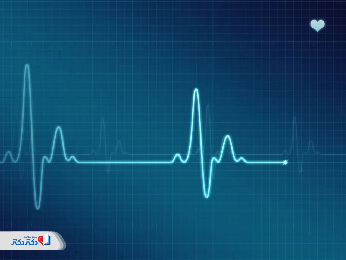 عکس نوار قلب فیبریلاسیون دهلیزی