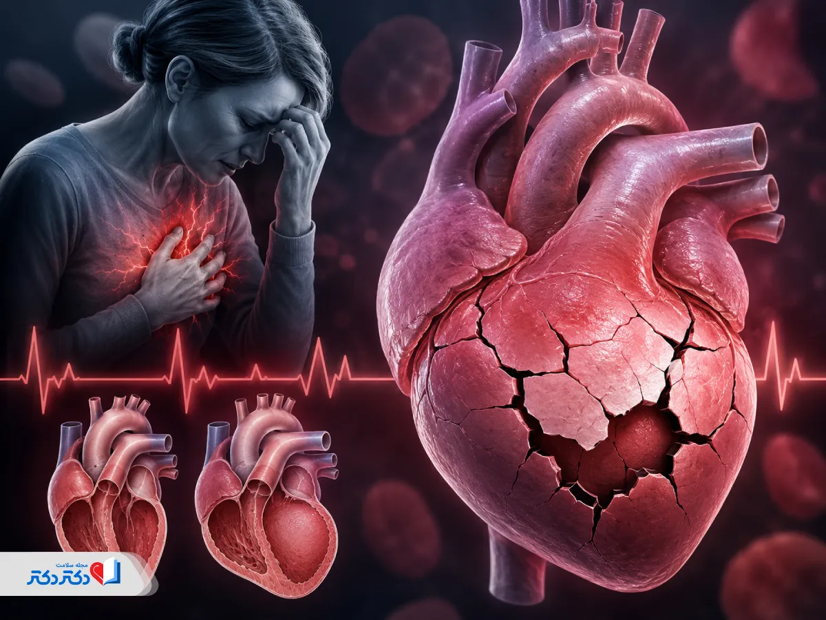 سندرم تاکوتسوبو یا کاردیومیوپاتی ناشی از استرس