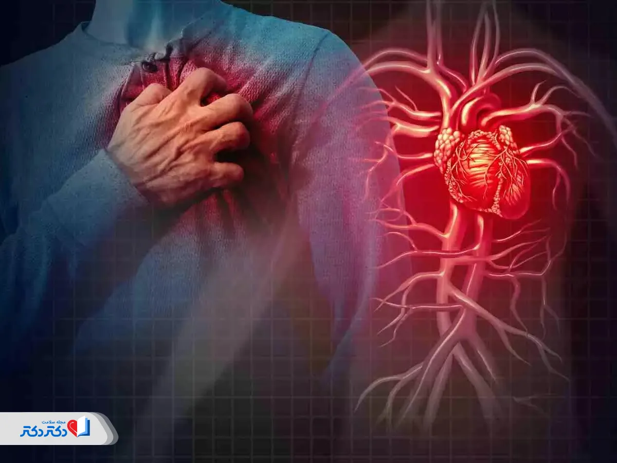 علائم پریکاردیت حاد