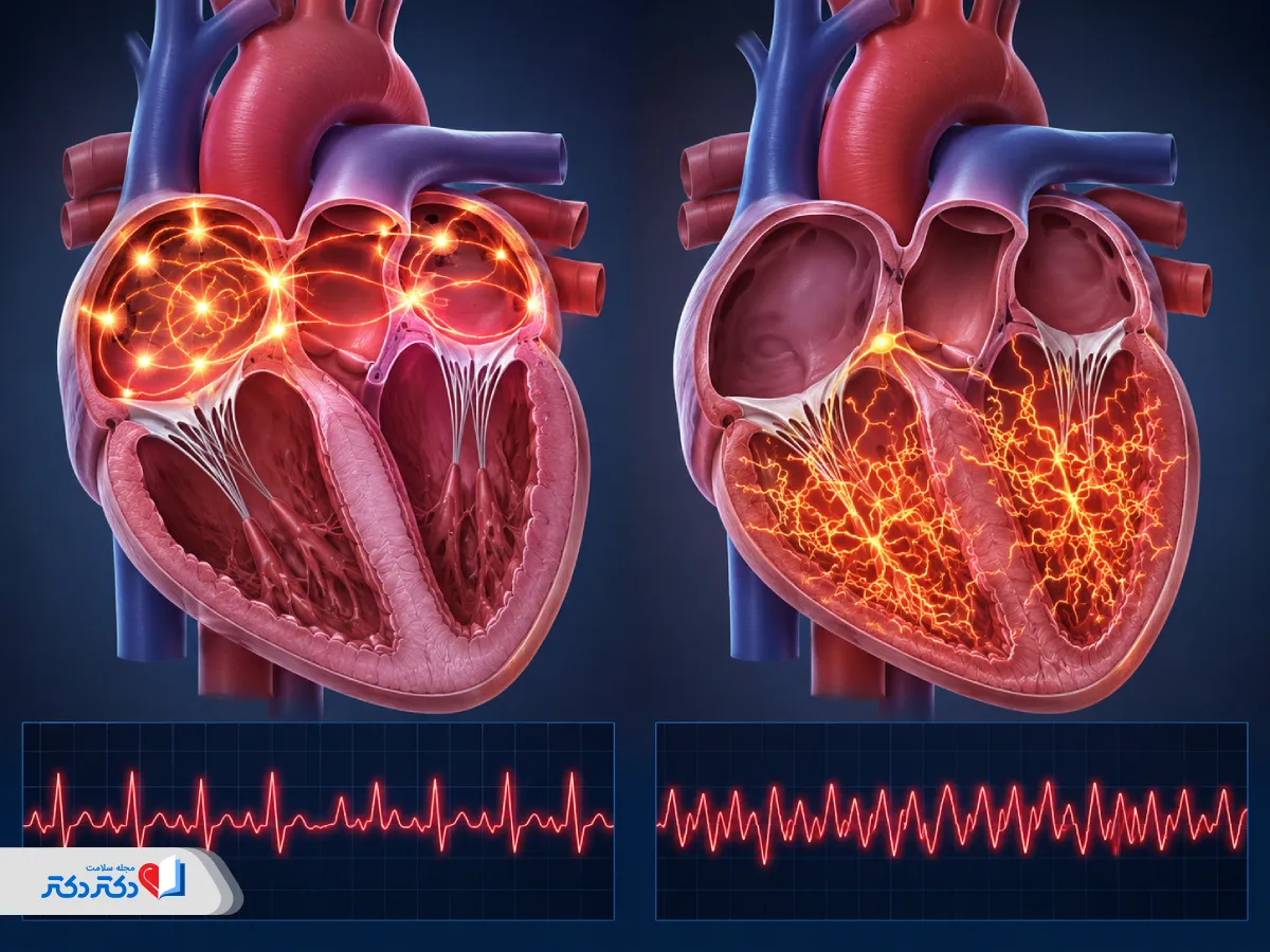 تفاوت فیبریلاسیون بطنی و فیبریلاسیون دهلیزی