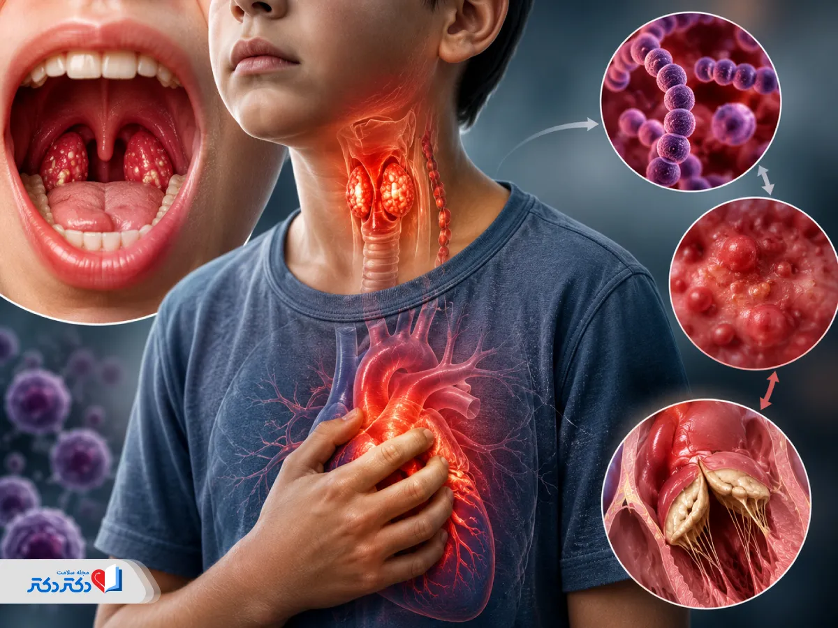 تب روماتیسمی علن رایج تنگی دریچه آئورت