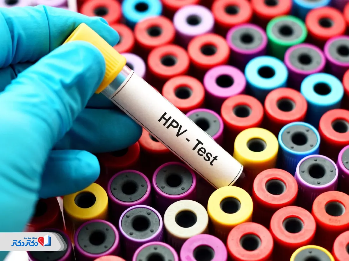 آزمایش hpv برای تشخیص CIN 1