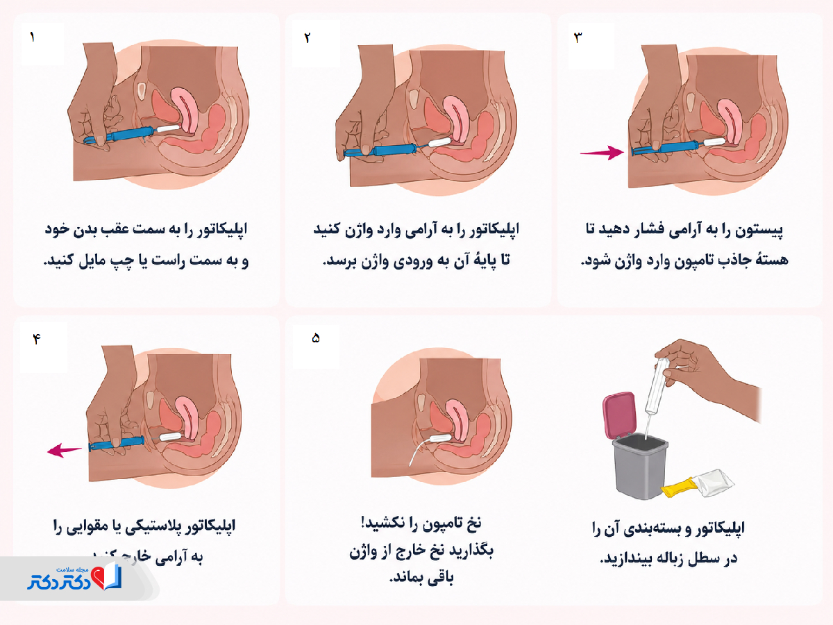 نحوه قراردادن تامپون