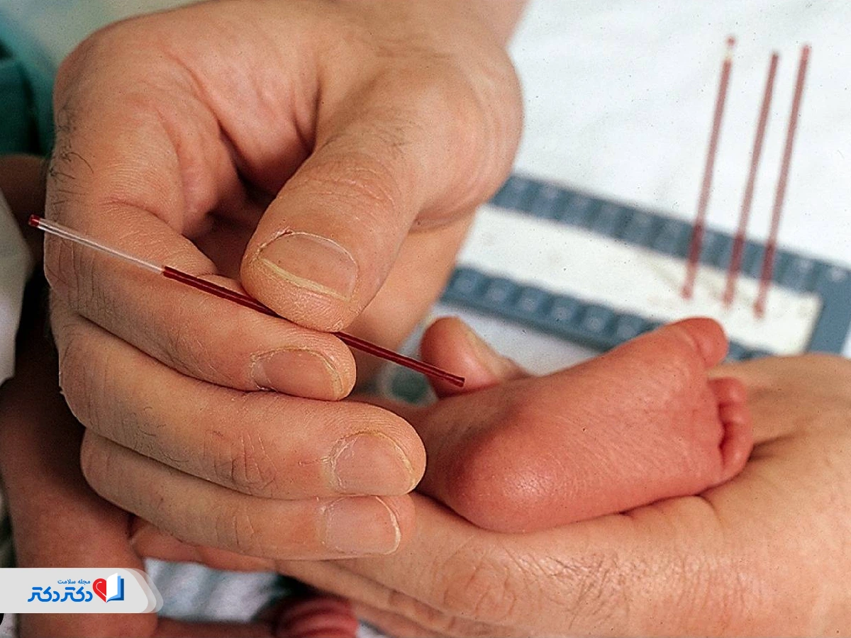 آزمایش گالاکتوزمی کلاسیک