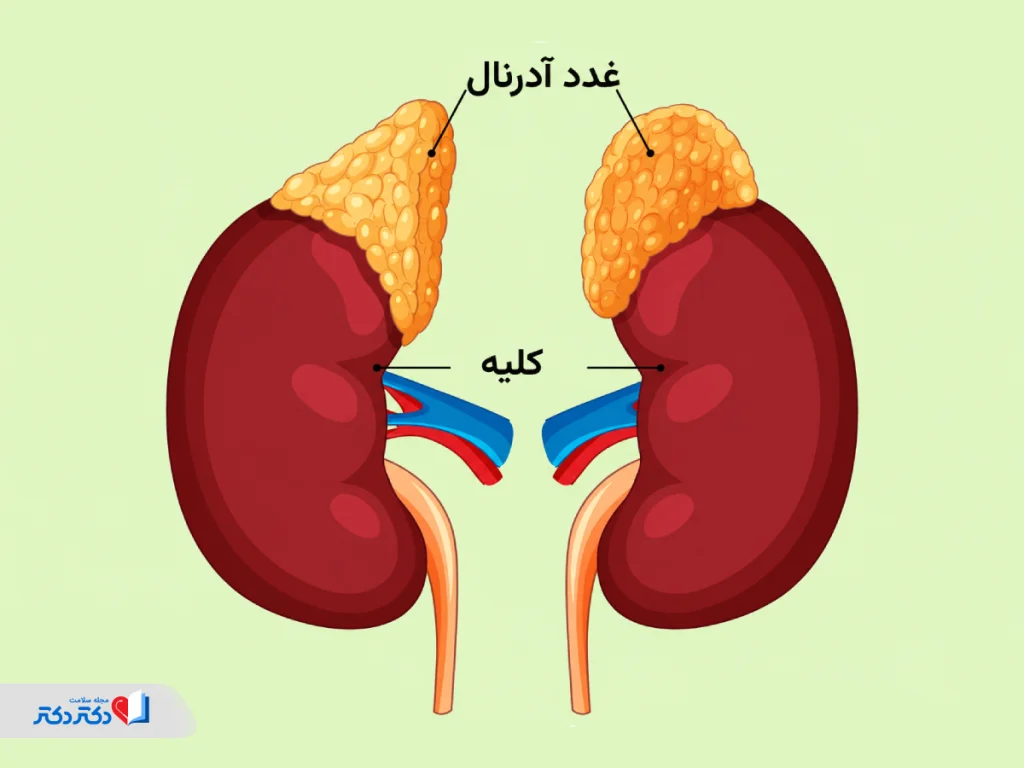 بیماری آدیسون