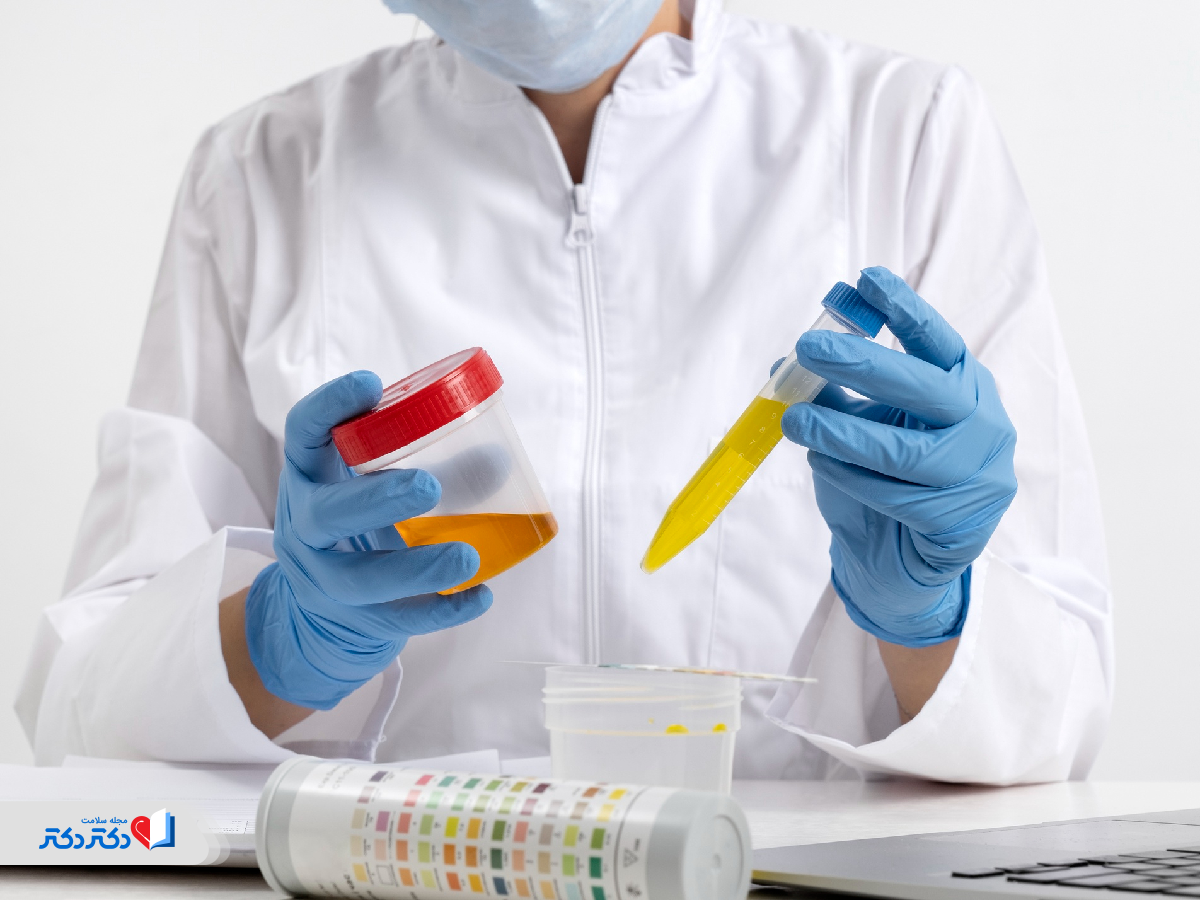 اسپاسم مثانه چگونه تشخیص داده میشود؟