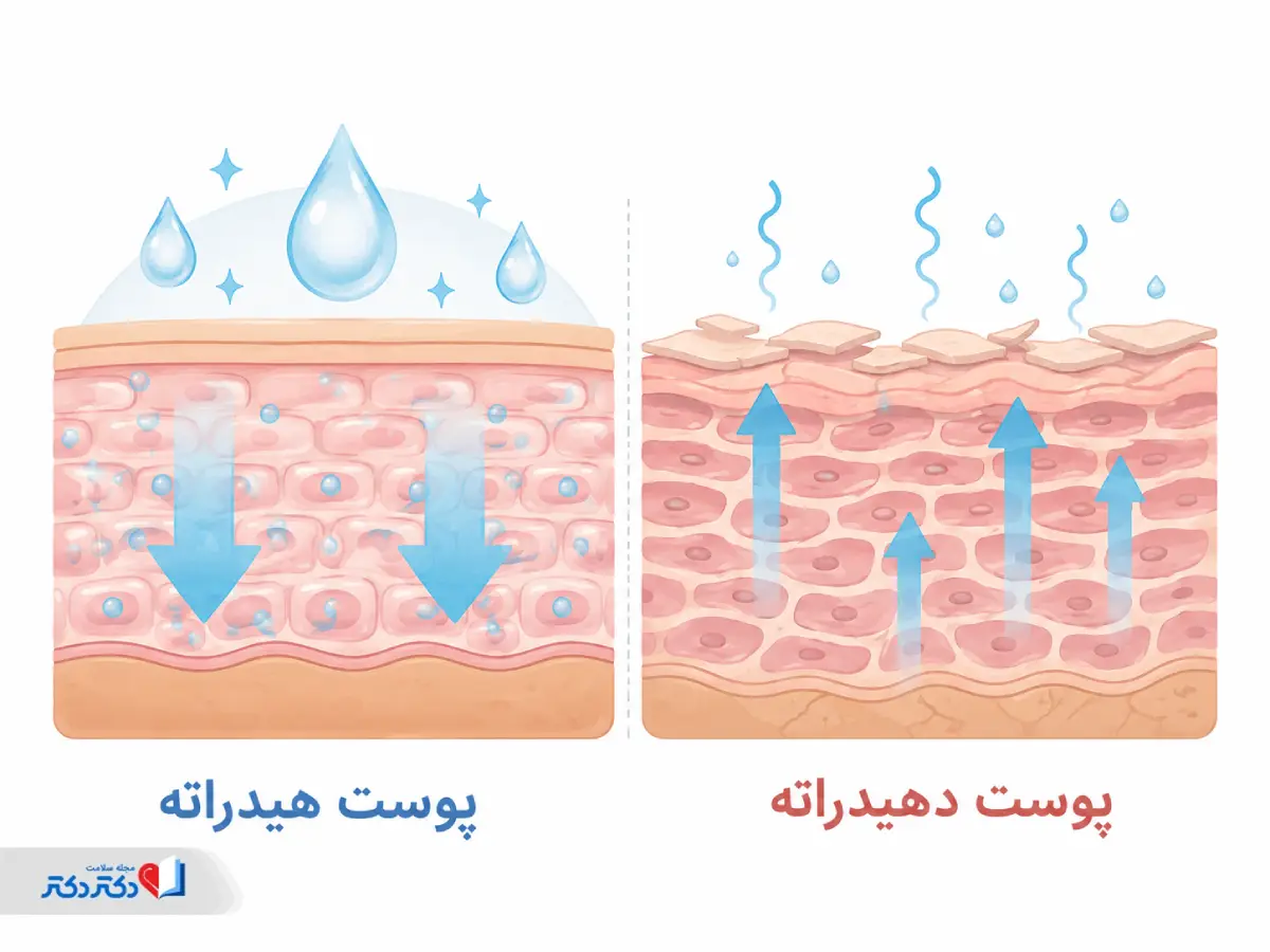 چرا پوست دهیدراته میشود؟