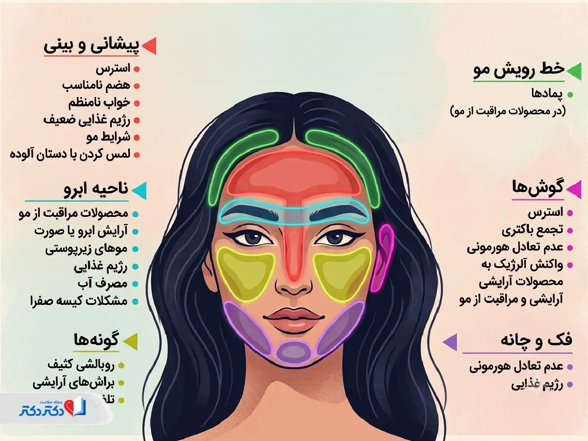 علت جوش نواحی مختلف پیشانی و صورت