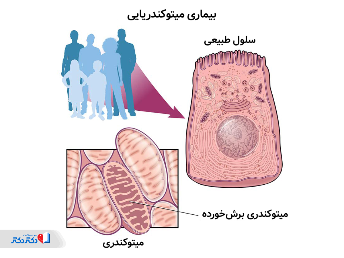 بیماری میتوکندریایی چیست؟