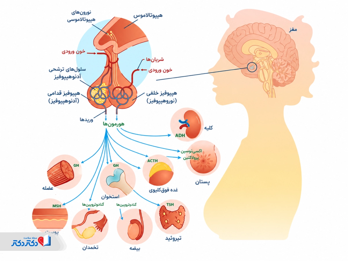 میکرو آدنوم هیپوفیز چیست