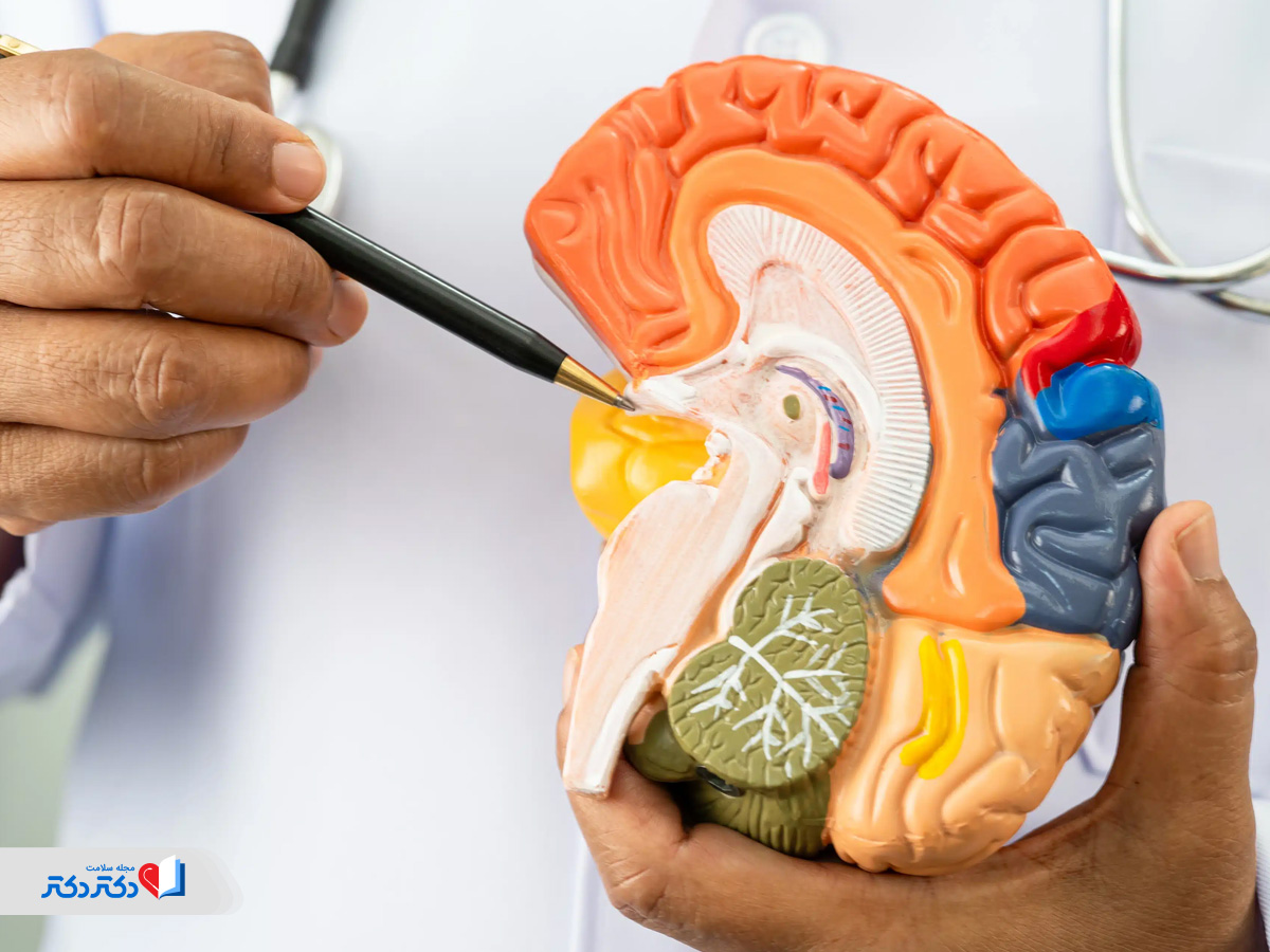 آدنوم هیپوفیز خوش خیم