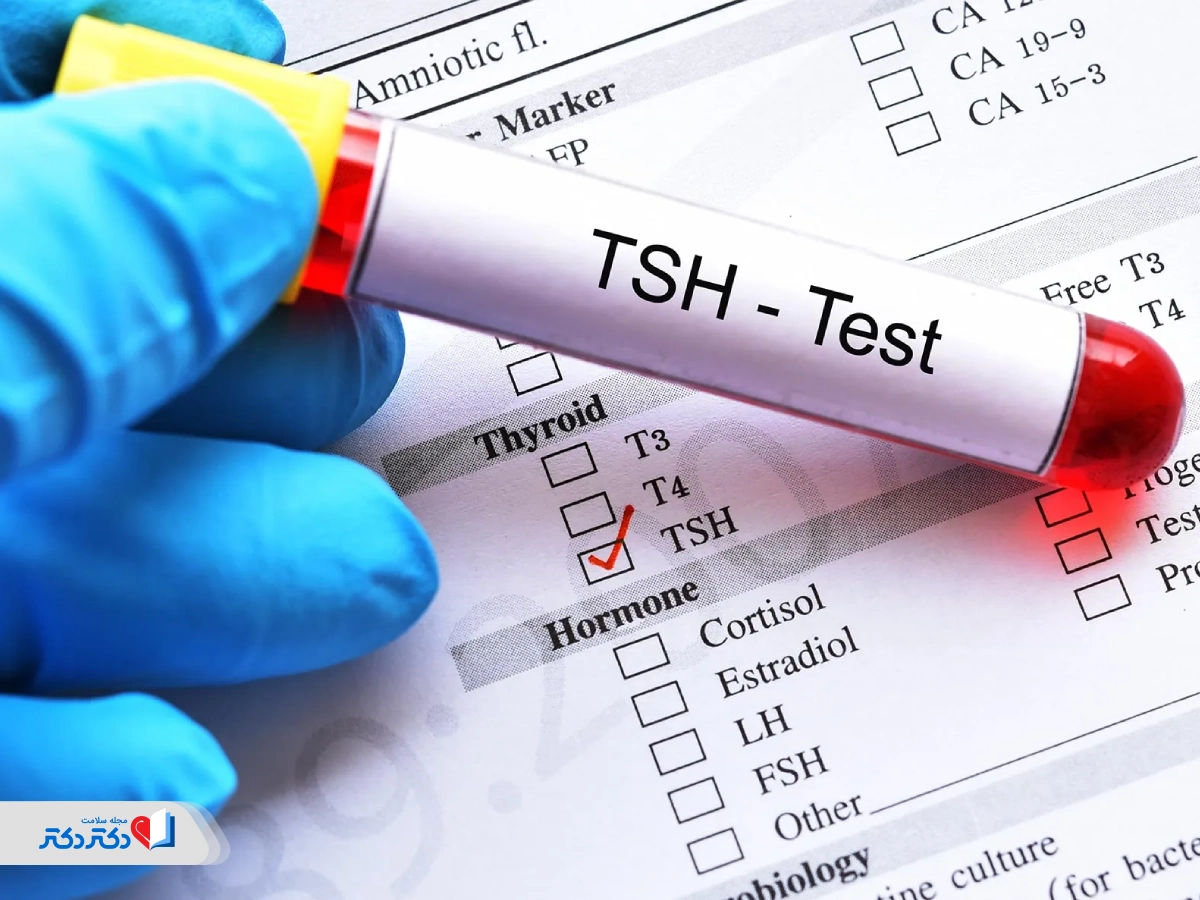 کمبود هورمون TSH ناشی از غده هیپوفیز چیست؟
