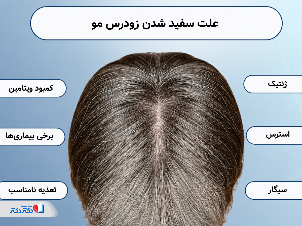 علت سفید شدن زودرس مو چیست