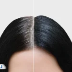 علت سفیدشدن زودرس مو؛ از ژنتیک تا کمبود ویتامین‌ها