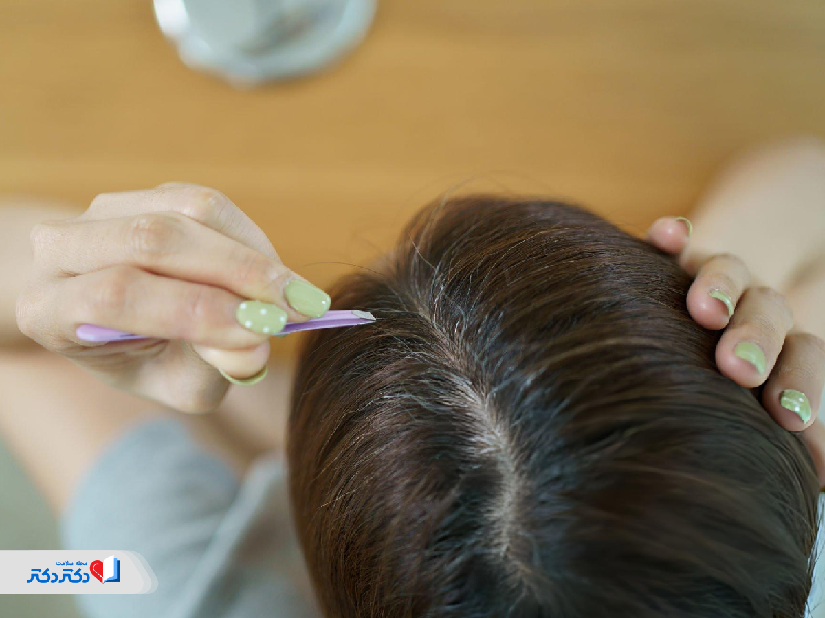 آیا درمانی برای سفید شدن زودرس مو وجود دارد؟