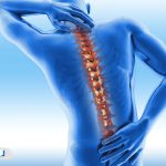 همه‌چیز درباره روماتیسم ستون فقرات؛ علائم، تشخیص، درمان و عوارض