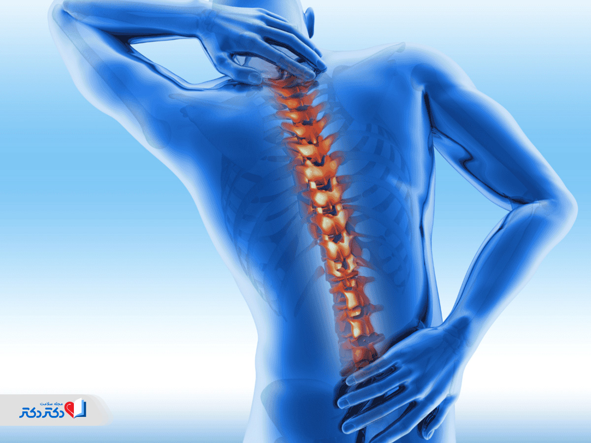 همهچیز درباره روماتیسم ستون فقرات؛ علائم، تشخیص، درمان و عوارض
