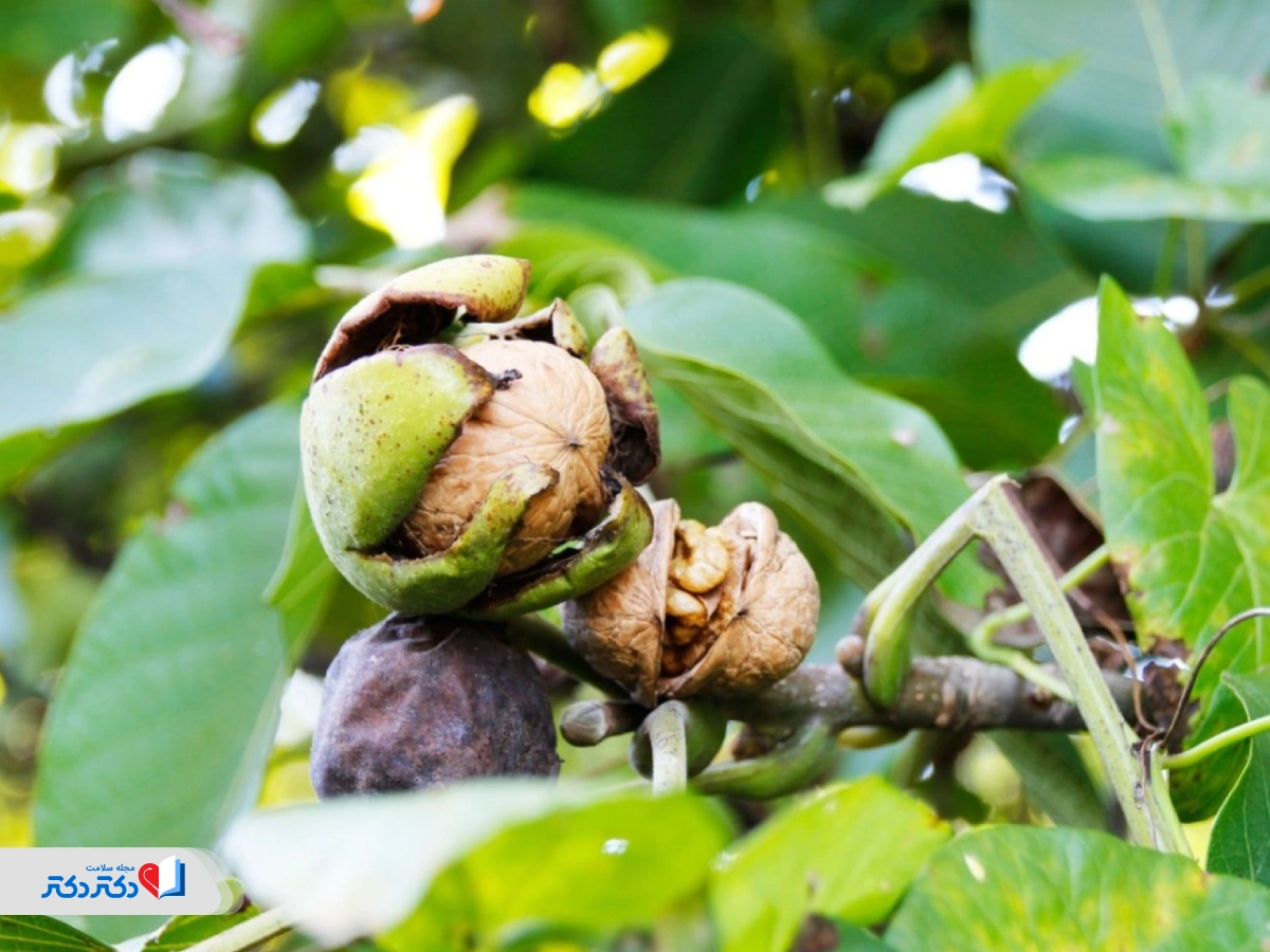 ارزش غذایی گردو برای لاغری