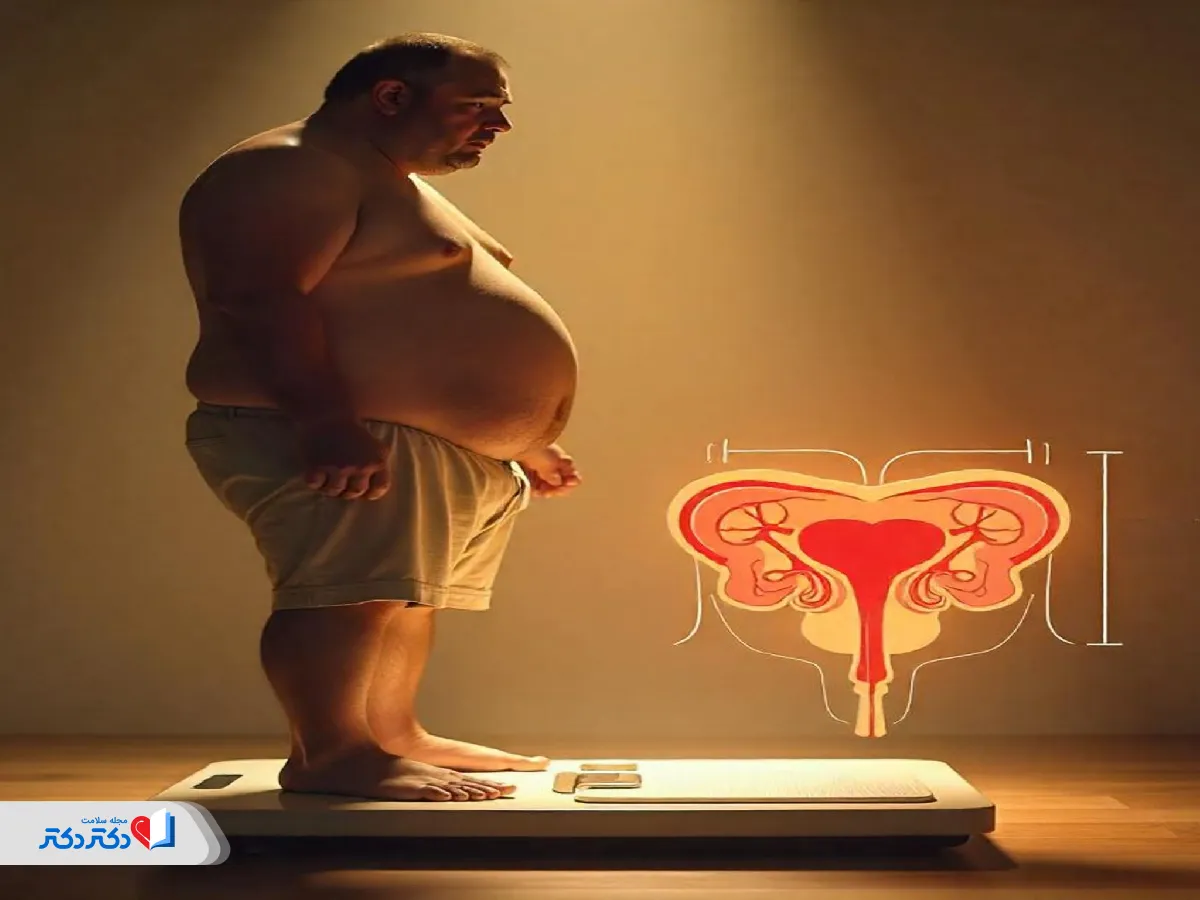 اضافه وزن یک علت مثانه بیش فعال