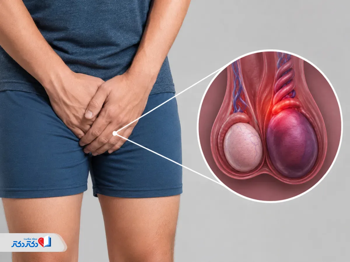 پیچخوردگی بیضه یک علت کوچک شدن بیضه