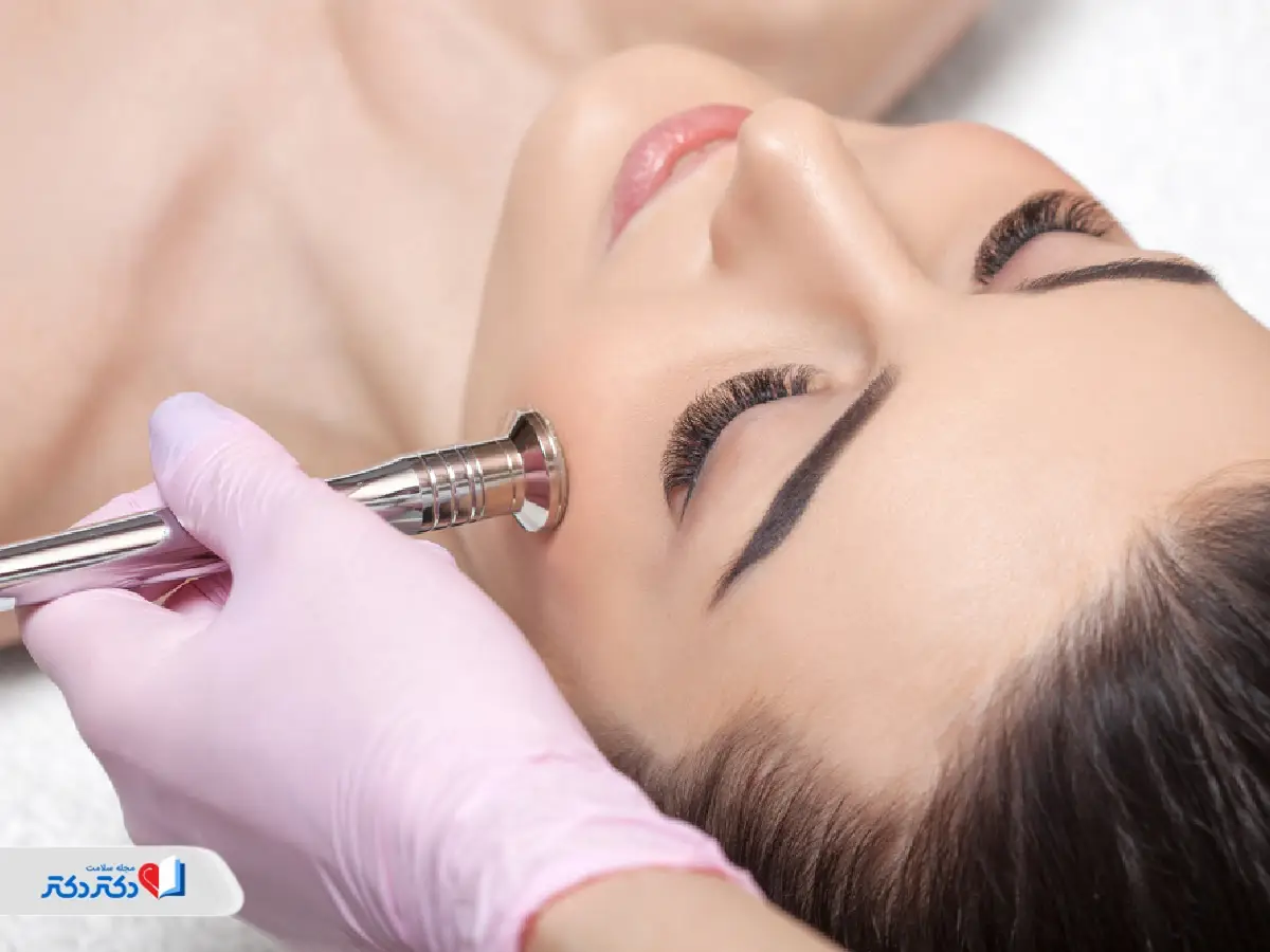 درمابریژن و میکرودرمابریژن برای ازبینبردن جای جوش