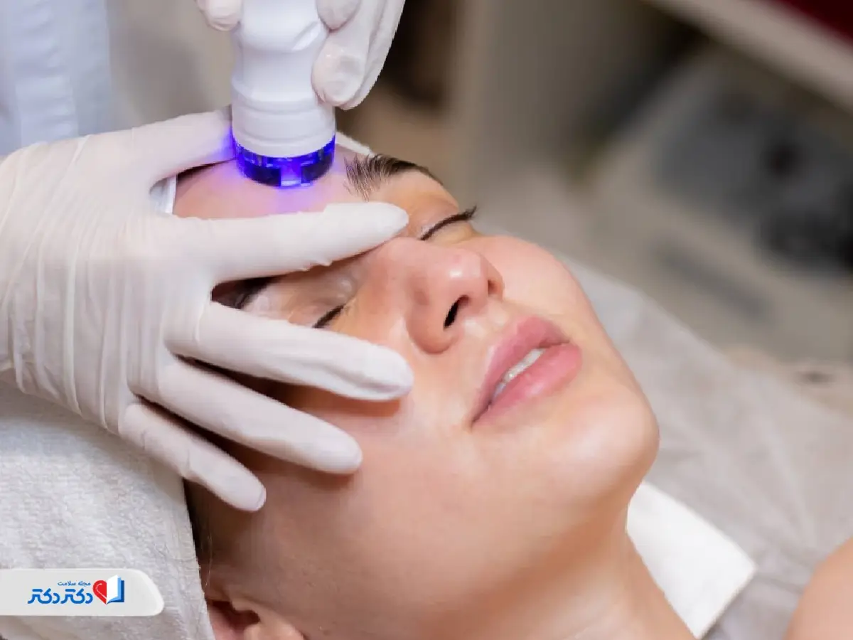 میکرونیدلینگ برای ازبینبردن جای جوش