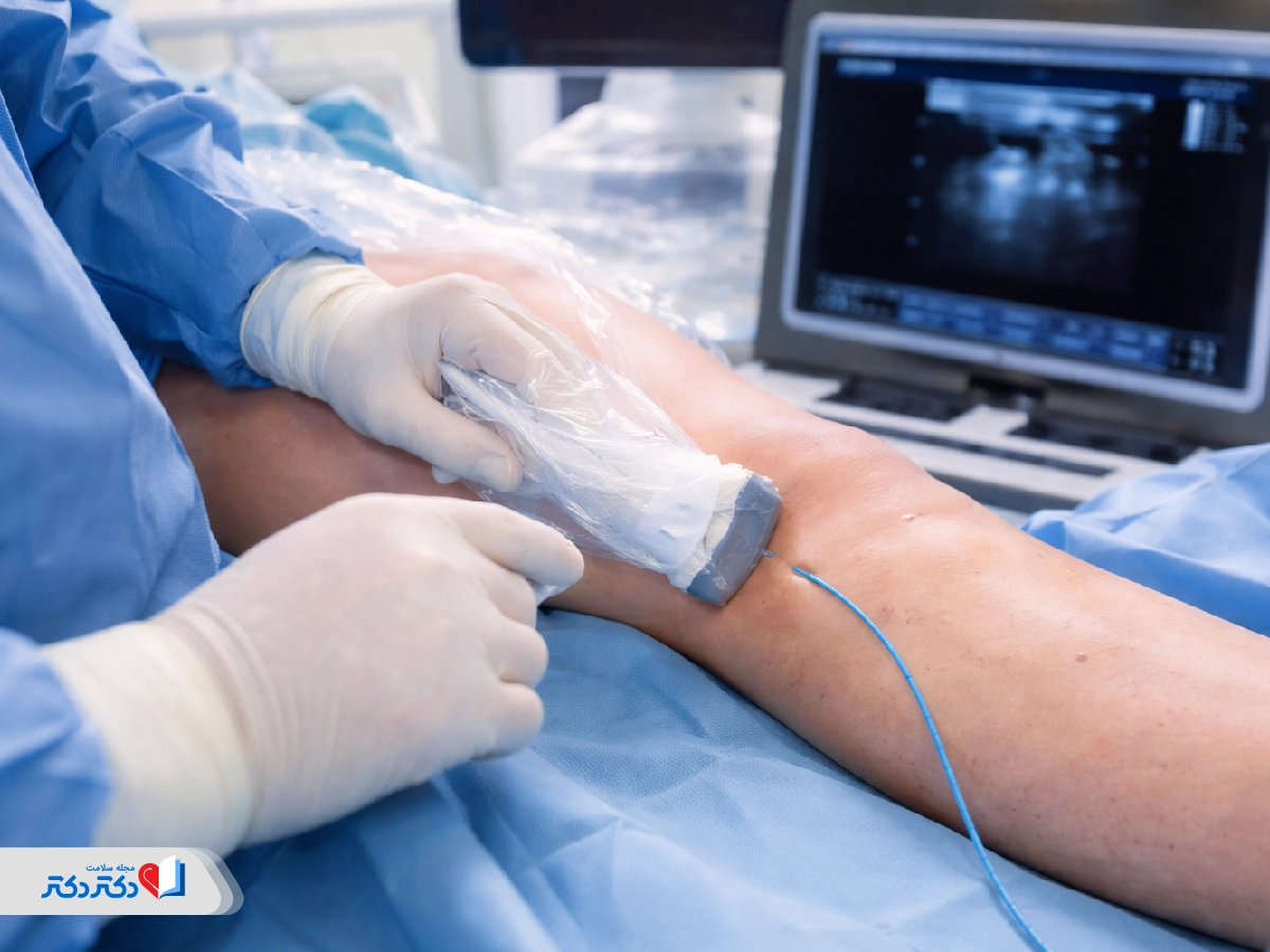 استفاده از کاتتر برای تشخیص پریکاردیت فشارنده