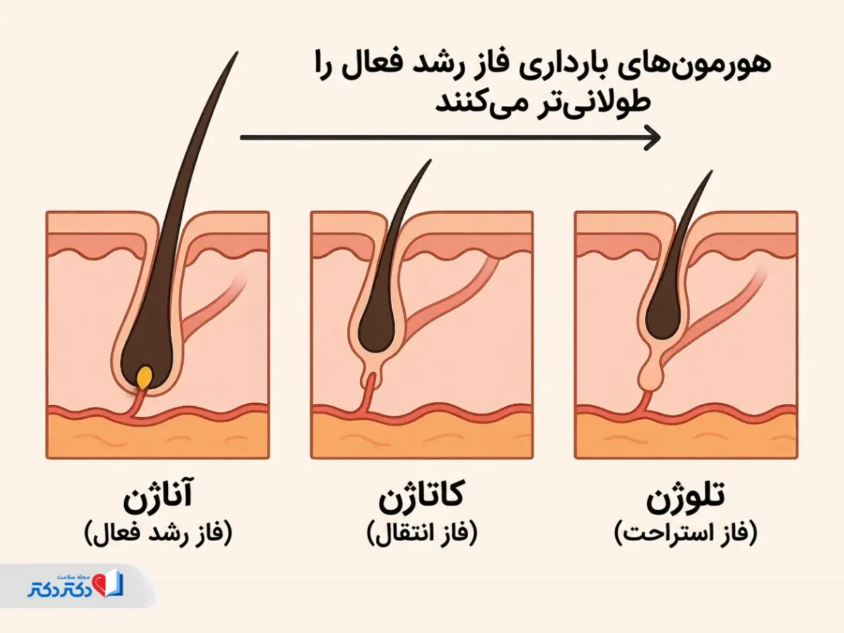تأثیر هورمونها بر لیزر موهای زائد در بارداری