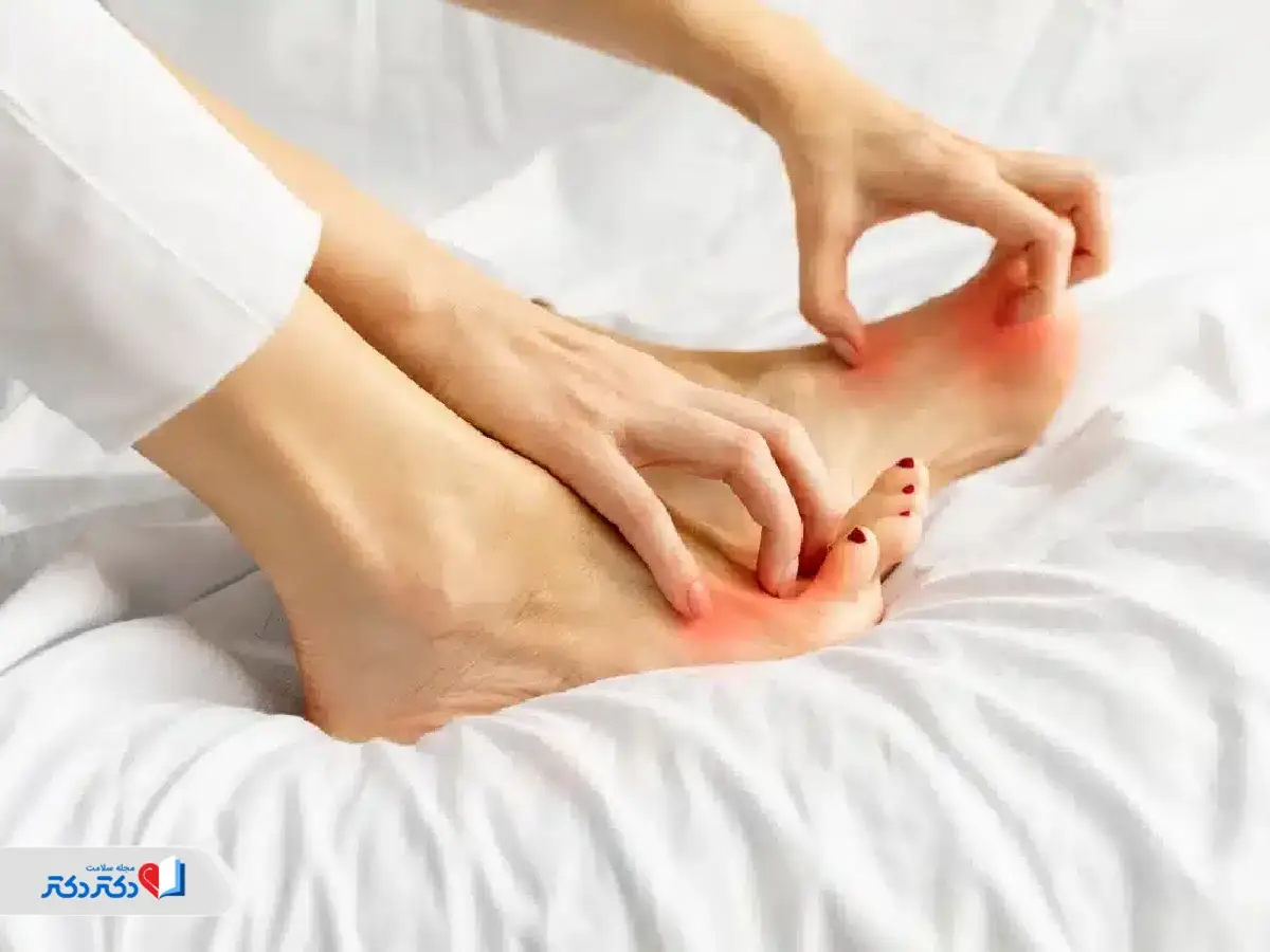 علت خارش کف پا در شب