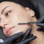 درماپلنینگ؛ هر آنچه درباره پاکسازی و لایه‌برداری پوست باید بدانید