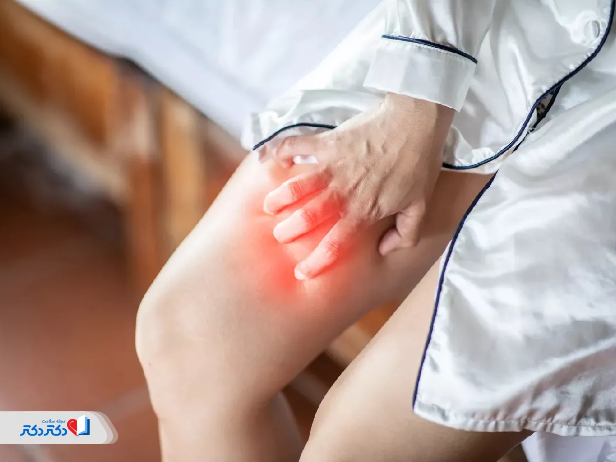 عکس تیرگی کشاله ران با خارش