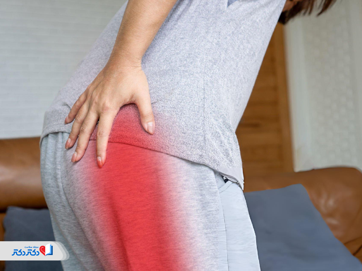 دیسک کمر و سیاتیک چه ارتباطی دارند؟