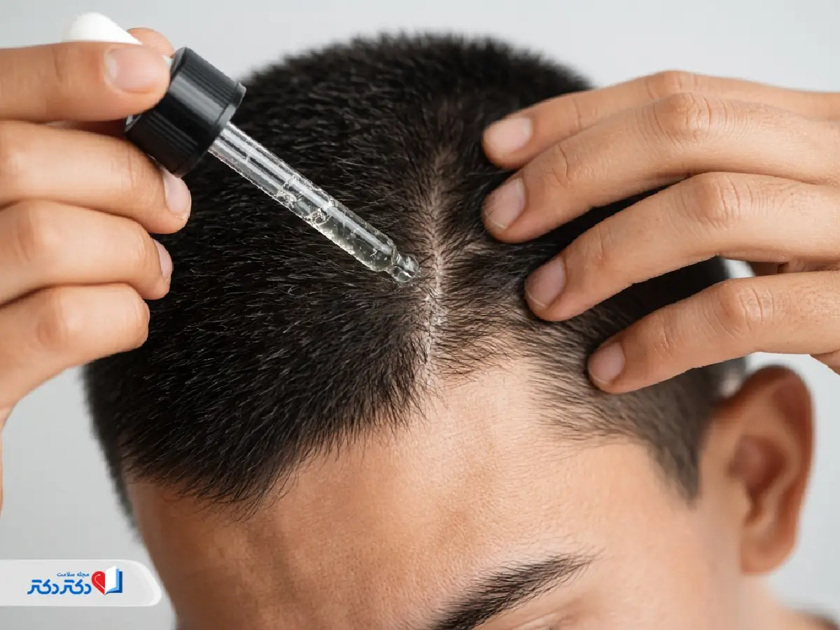 چگونه از روغن رزماری برای مو استفاده کنیم؟