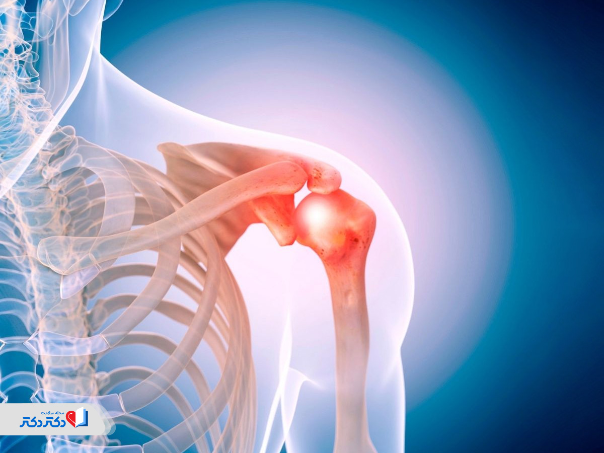 التهاب تاندون شانه چگونه ایجاد میشود و راه درمان چیست؟
