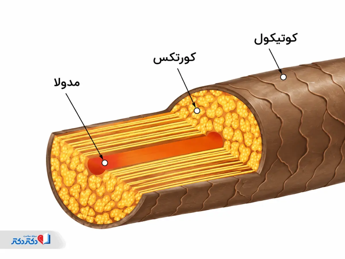 ساختار ساقه مو برای درک بهتر نحوه ایجاد موخوره
