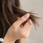 موخوره از چیست؟ علائم، انواع، دلایل ایجاد و راه‌های درمان