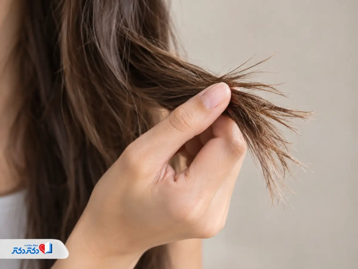 موخوره از چیست؟ علائم، انواع، دلایل ایجاد و راه‌های درمان