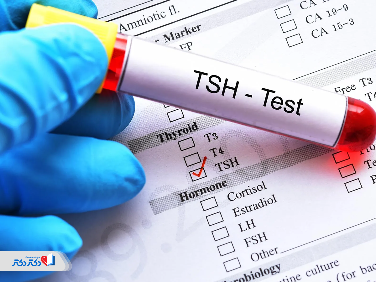 آزمایش TSH قبلاز تزریق آمپول لاغری